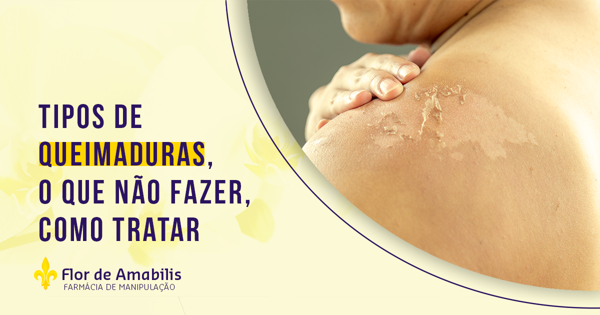 Como Aliviar Queimadura No Céu Da Boca